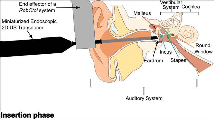 Endoscopic Ultrasound