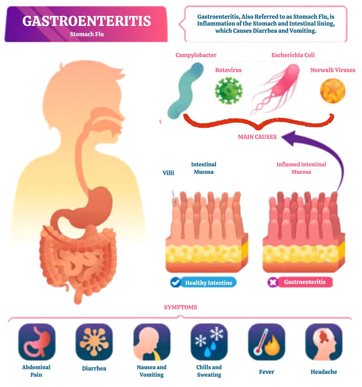 Gastroenteritis (1).jpg
