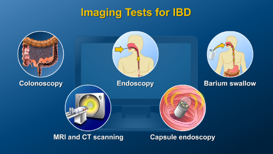 ibd imaging